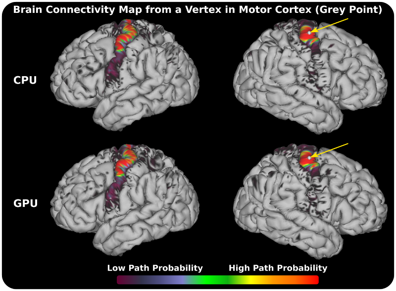 Generation of Connectome using ProbtrackxGPU