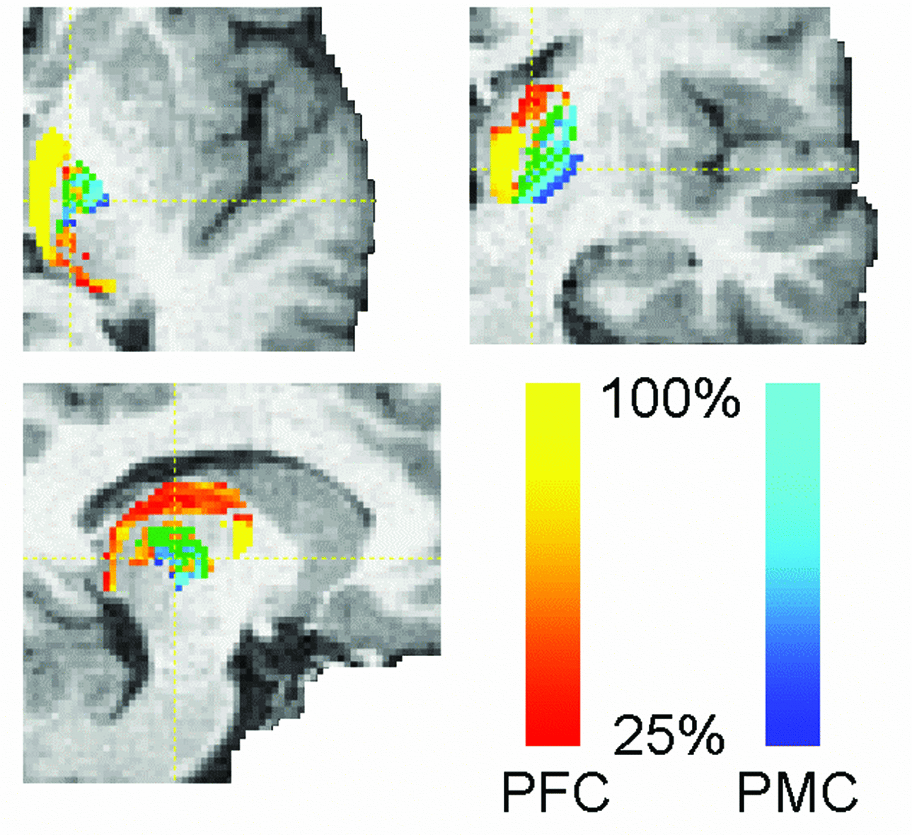 connectivity-based classification of thalamus