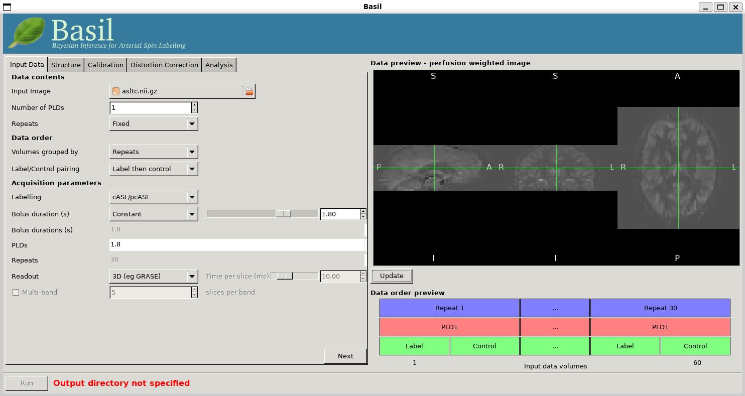 BASIL GUI previewing perfusion-weighted
  image