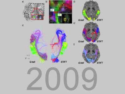 structure tensor informed fibre tractography (STIFT)