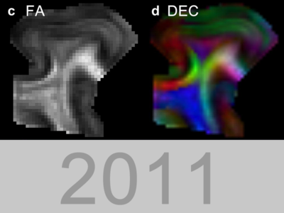 diffusion MR microscopy of the neocortex