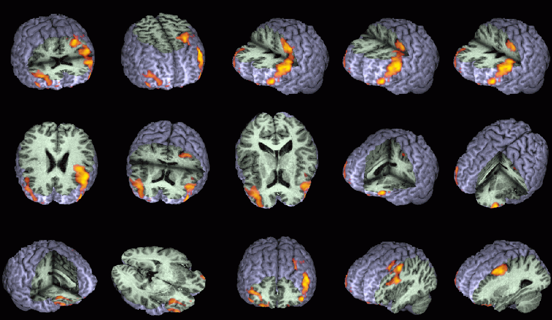 Creative Intelligence fMRI